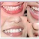 ����ǻҽԺר... ����ǻҽԺר����ѯ�绰:022-85754978